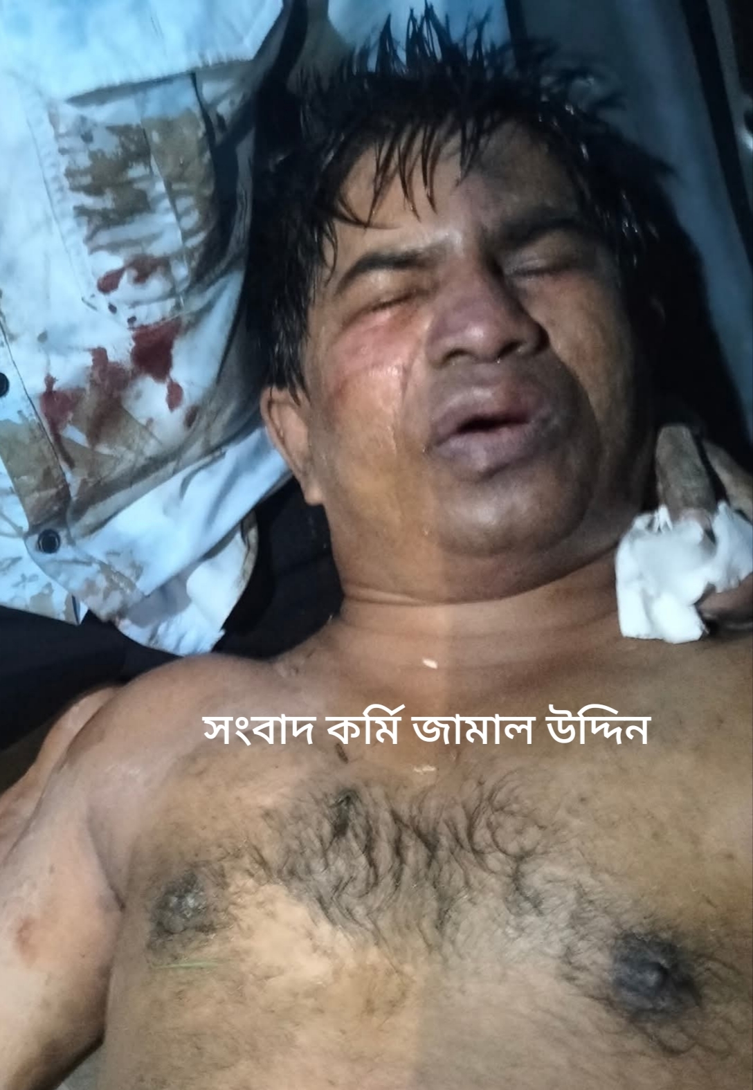 হ্নীলা ইউনিয়নের সাবেক ইউপি সদস্য ও সংবাদকর্মী জামাল উদ্দিনের ওপর সশস্ত্র হামলা, অপহরণ ও নির্যাতনের ঘটনায় নিন্দা ও উদ্বেগ।